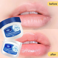 Vaseline-Moisturizing-Lip-Balm
